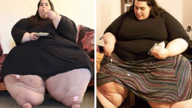 Jovem obesa de 25 anos perde mais de 180kg, fica lindíssima e fotos impressionam