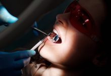 Quanto custa lentes de contato dental: Principais fatores a considerar